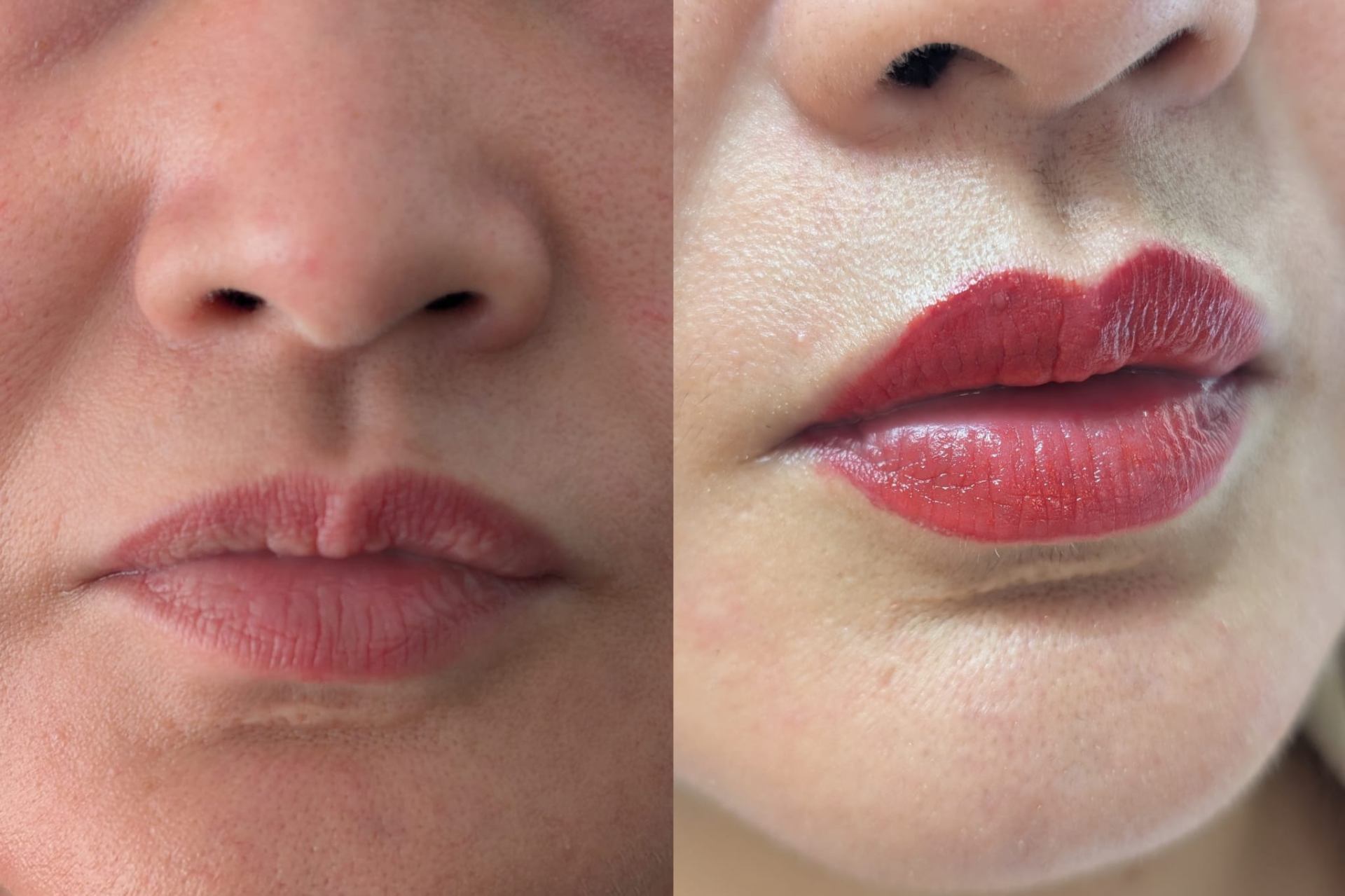 Antes y después de micropigmentación de labios en Efluvi